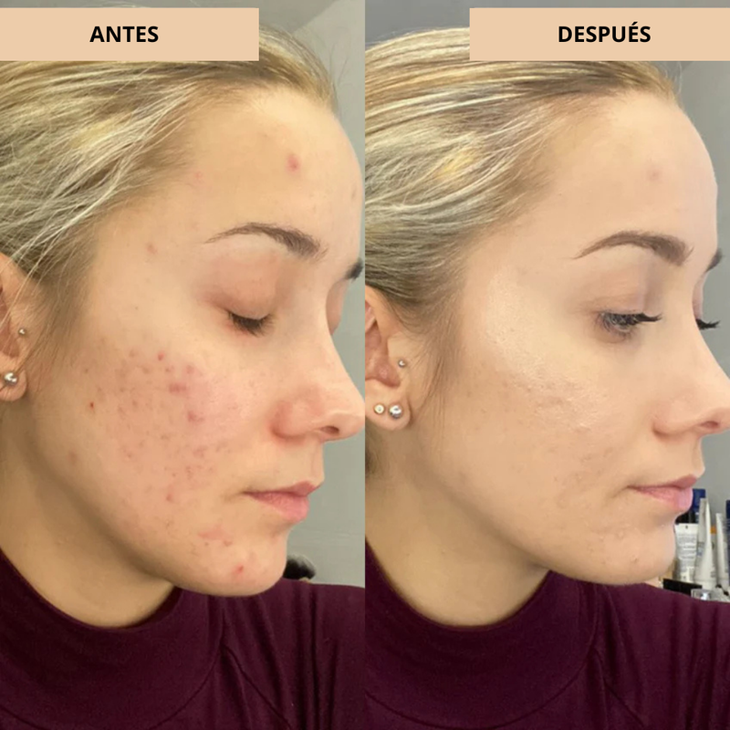 Crema Ligera e Hidratante para un Acabado Radiante y Natural (OFERTA 2X1)