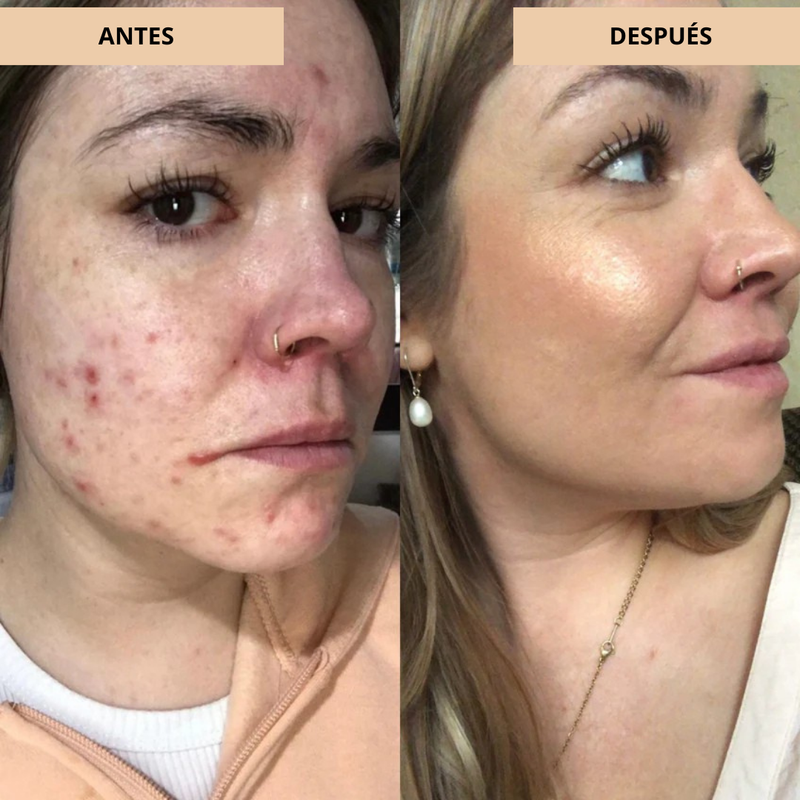 Crema Ligera e Hidratante para un Acabado Radiante y Natural (OFERTA 2X1)